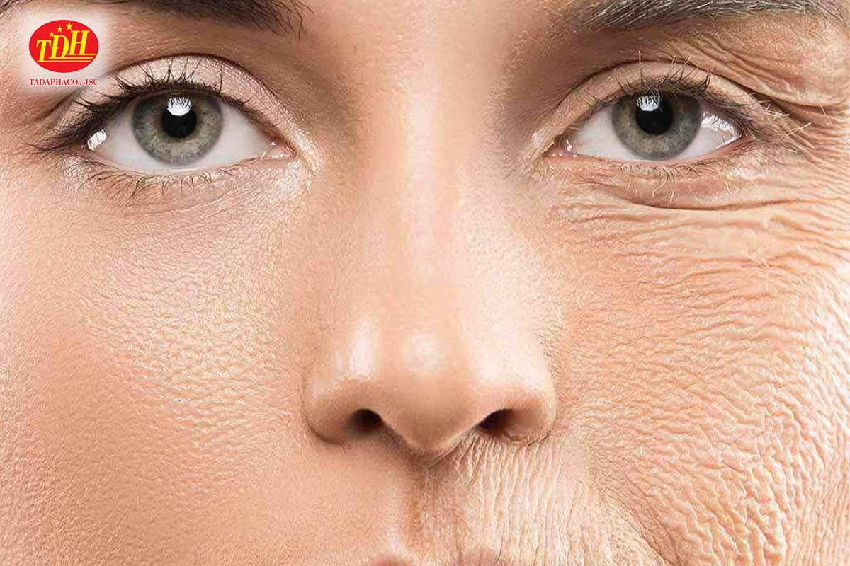 Ưu điểm làm đẹp da hiệu quả của Collagen Peptide